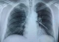 Фото: Қызылорда облыстық көпбейінді ауруханасы